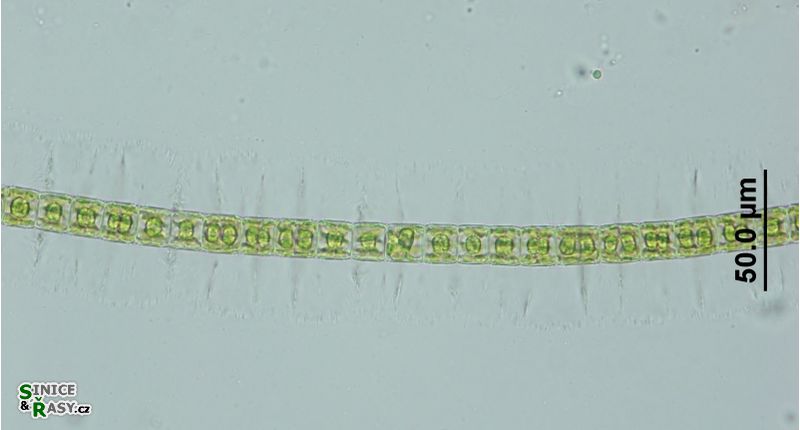 Hyalotheca dissiliens