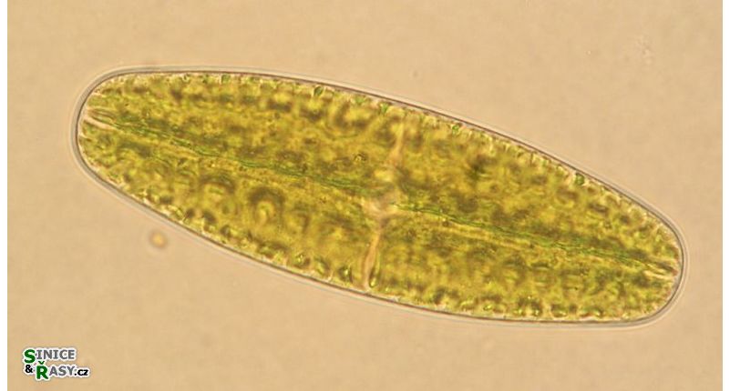 Netrium digitus
