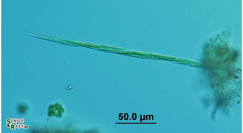 Monoraphidium griffithii