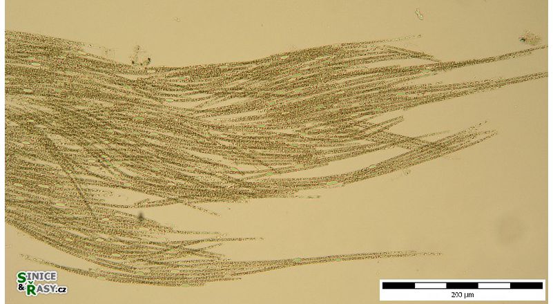 Aphanizomenon flos-aquae