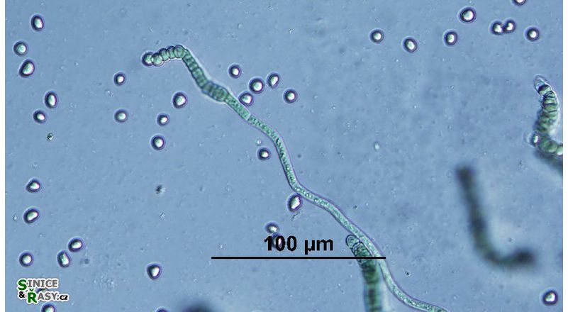 Westiellopsis prolifica