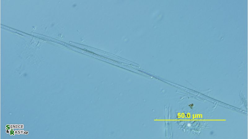 Nitzschia seriata
