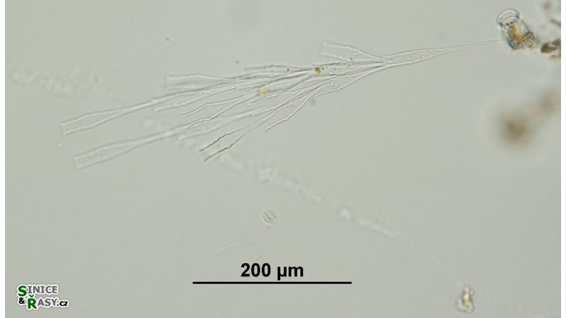 Dinobryon bavaricum