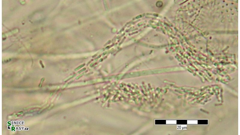 Bacularia gracilis