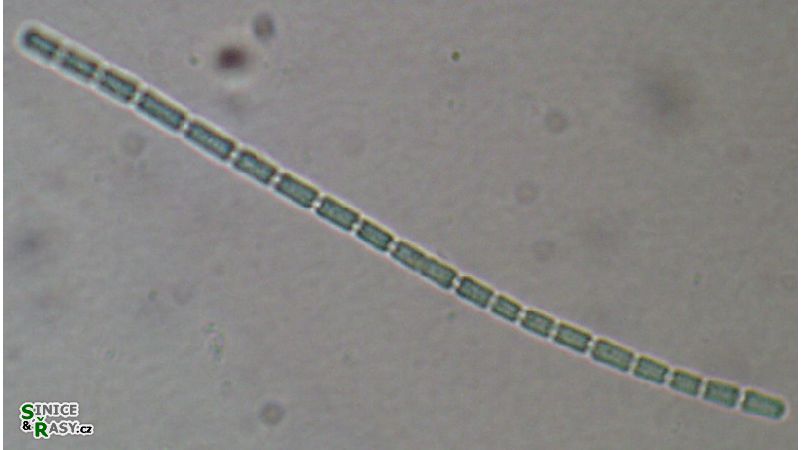 Pseudanabaena catenata