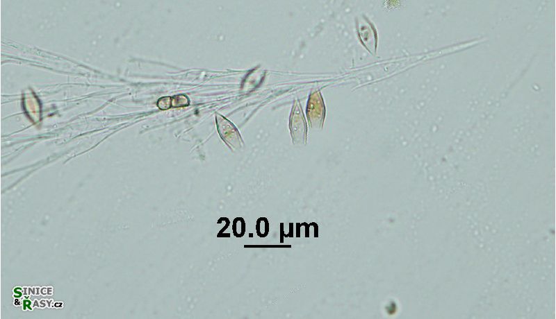 Epipyxis utriculus