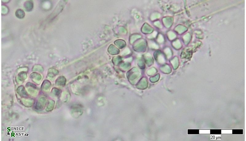 Cyanosarcina