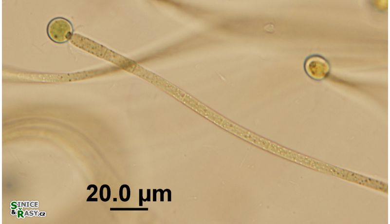 Gloeotrichia intermedia