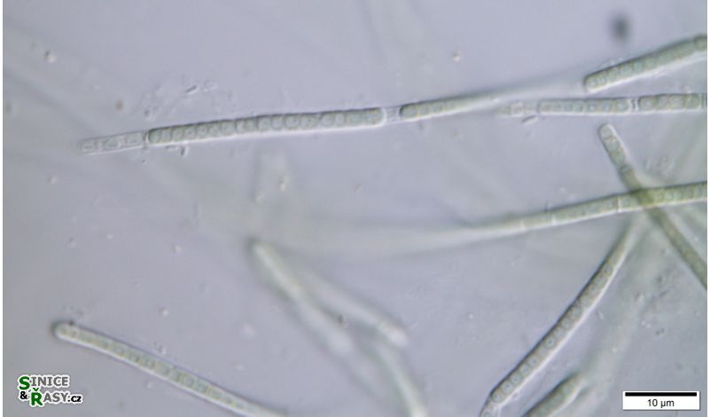 cf. Phormidesmis 