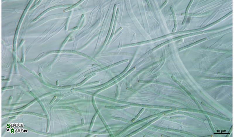 Oculatella
