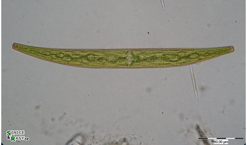 Closterium costatum