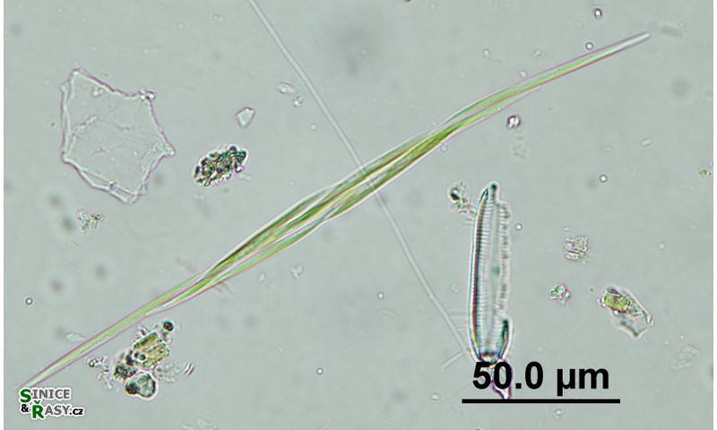 Monoraphidium griffithii