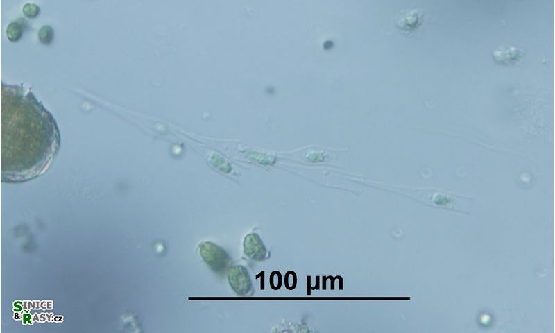 Dinobryon bavaricum