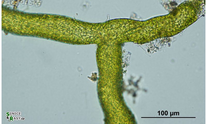 Vaucheria sessilis