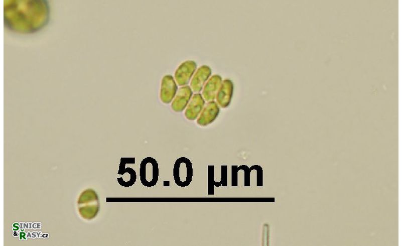 Scenedesmus obtusus var. disciformis