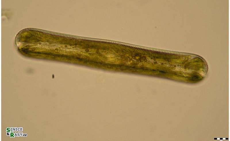 Pinnularia nobilis