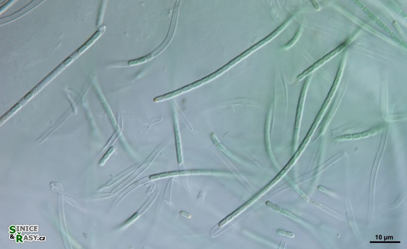 Oculatella