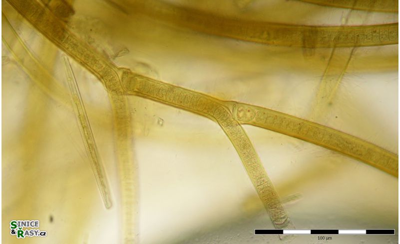 Tolypothrix distorta