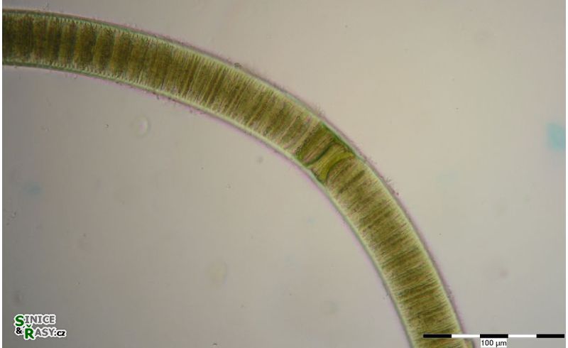 Lyngbya aestuarii
