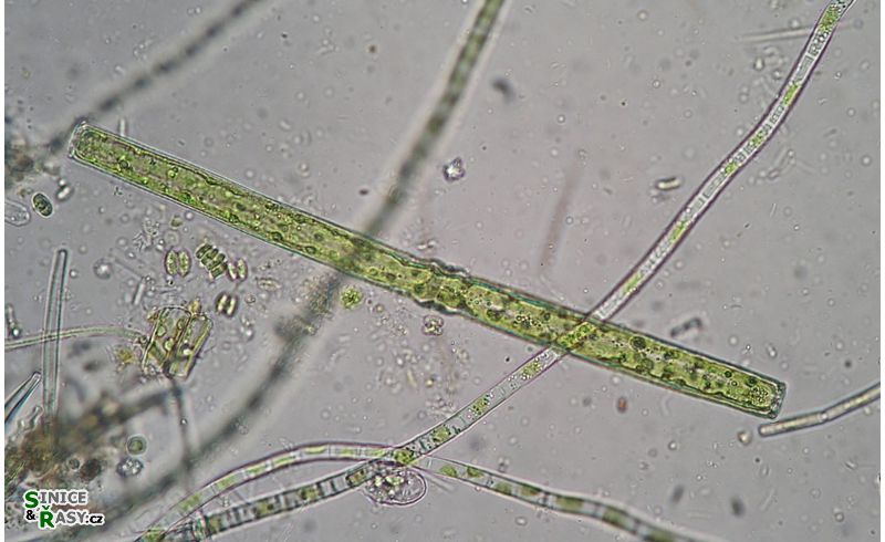 Pleurotaenium ehrenbergii