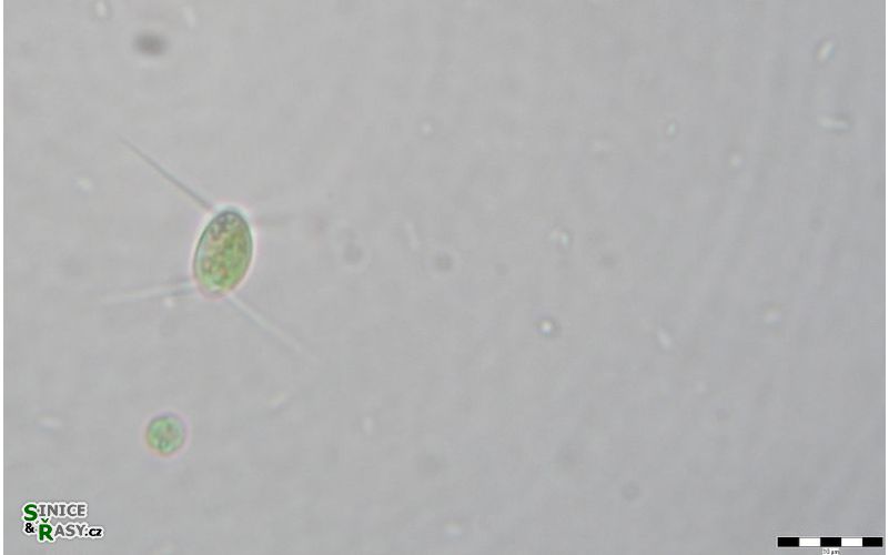 Lagerheimia genevensis