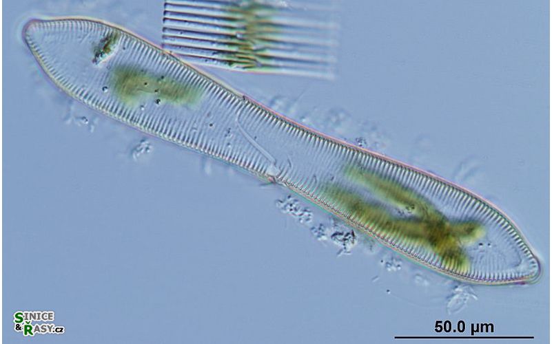 Cymatopleura solea
