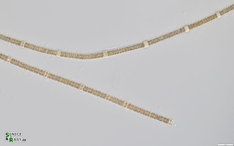 Nodularia spumigena