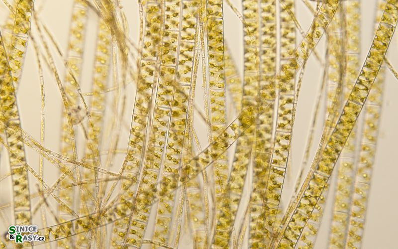 Spirogyra