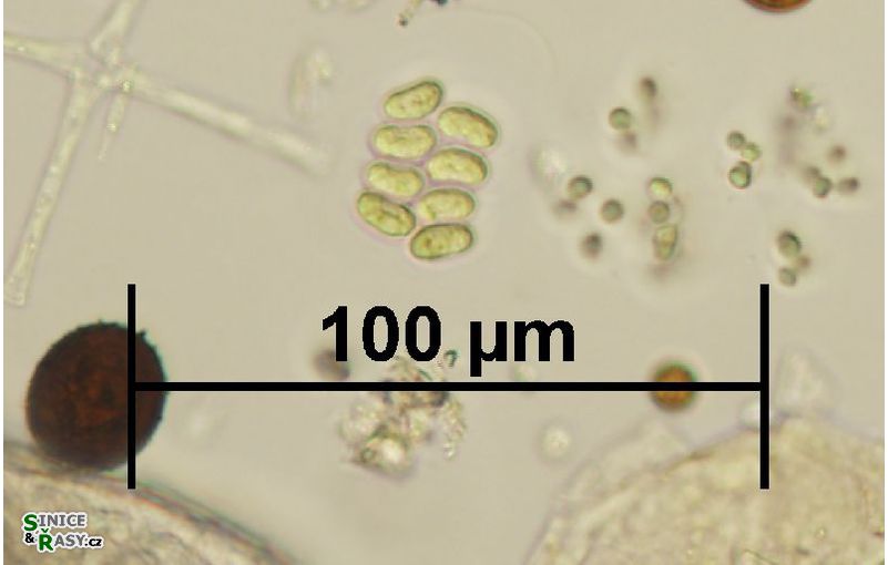 Scenedesmus obtusus var. disciformis