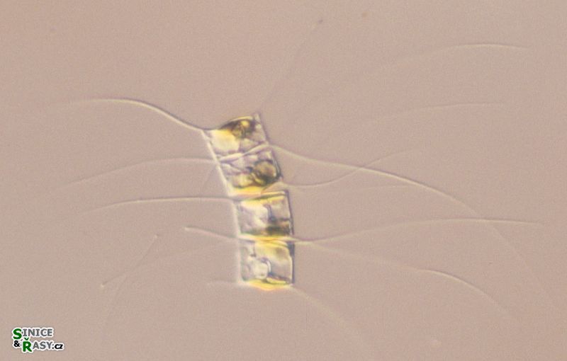 Chaetoceros