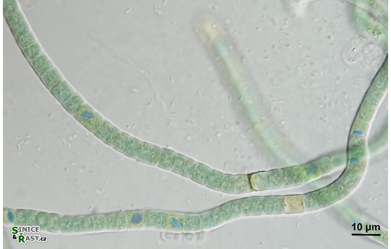 Scytonema