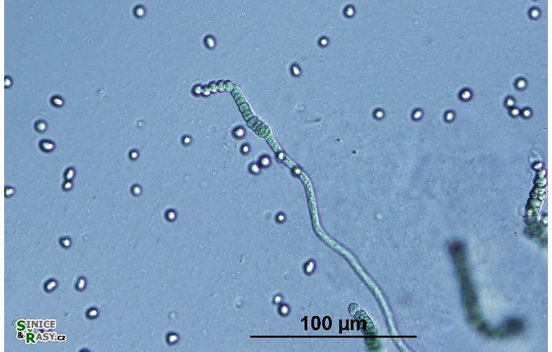 Westiellopsis prolifica