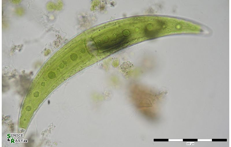 Closterium moniliforme