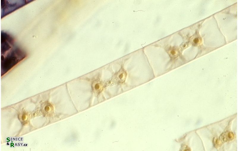 Zygnema
