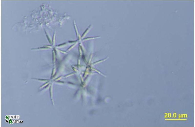 Actinastrum aciculare