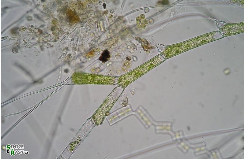 Bulbochaete