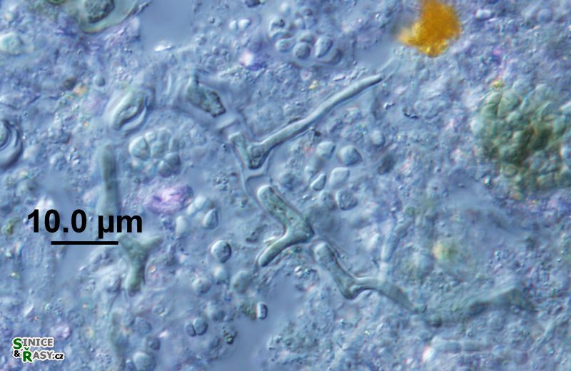 Tryponema cf. endolithicum