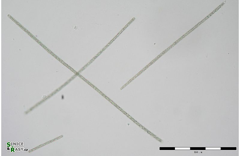 Planktothrix agardii