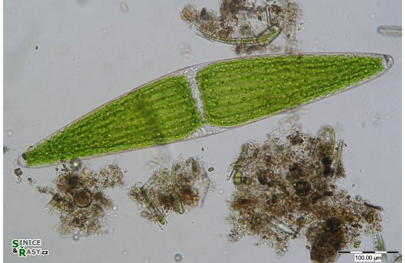 Closterium lunula