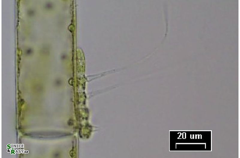Aphanochaete sp.