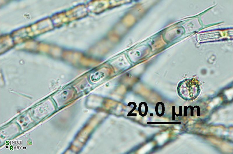 Microspora sp. 