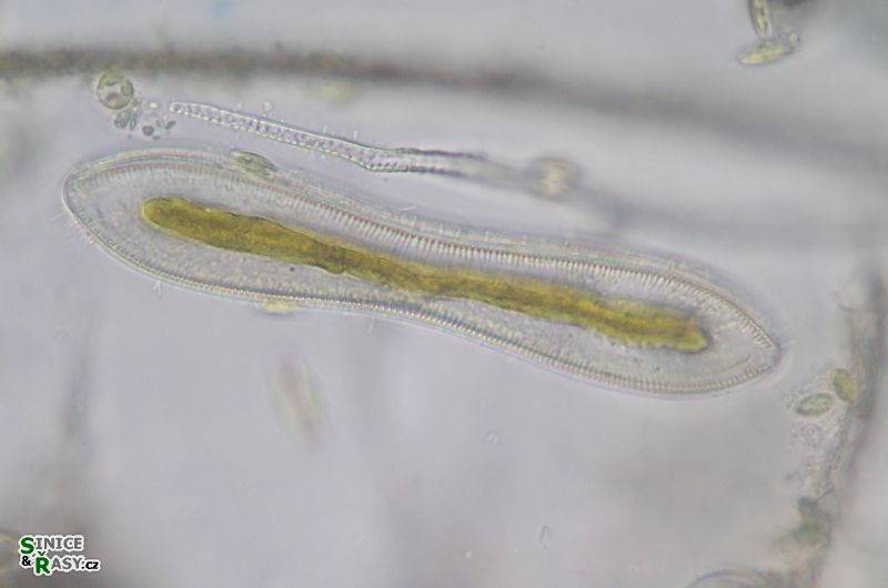 Cymatopleura solea