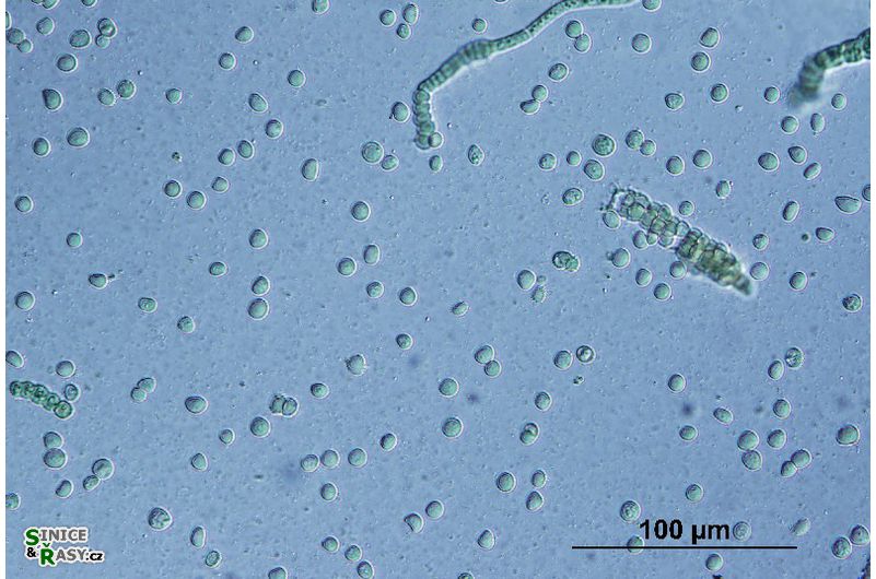 Westiellopsis prolifica