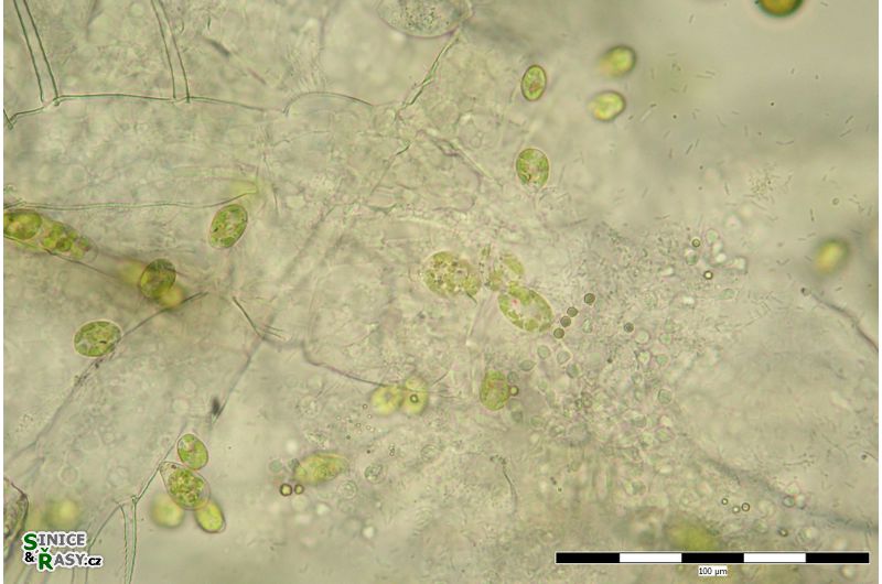 Colacium cyclopicola