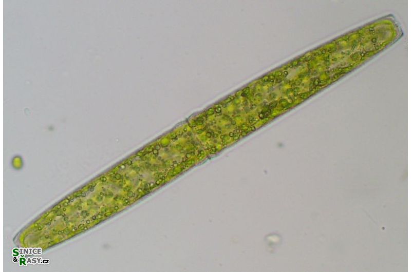 Pleurotaenium crenulatum