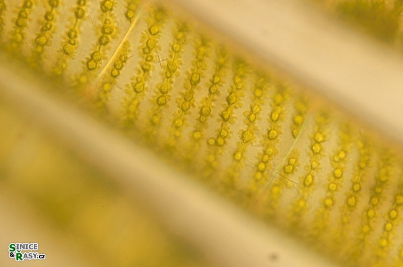 Spirogyra