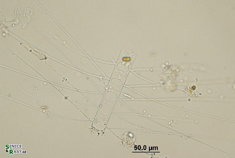 Chaetoceros sp. 