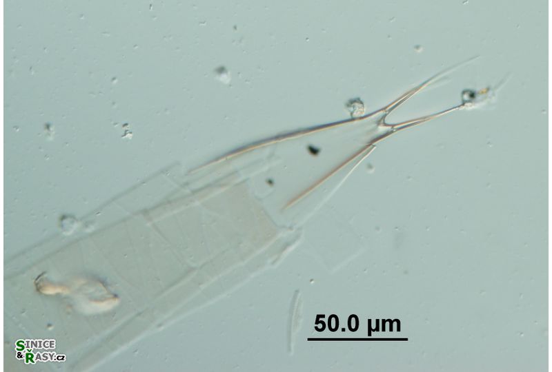 Rhizosolenia hebetata f. semispina