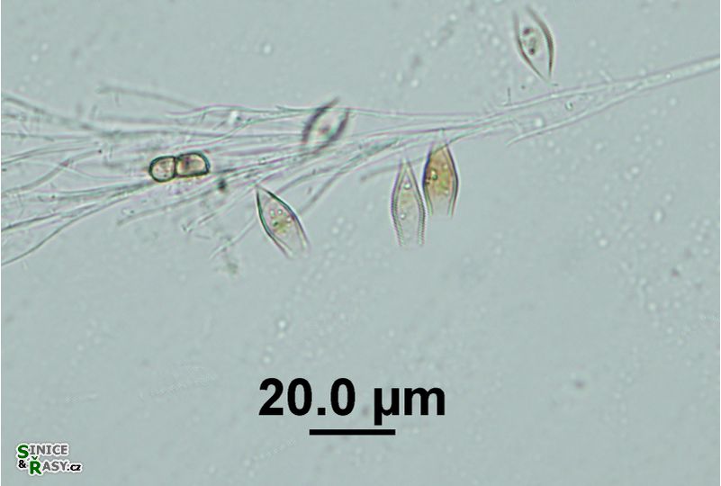 Epipyxis utriculus