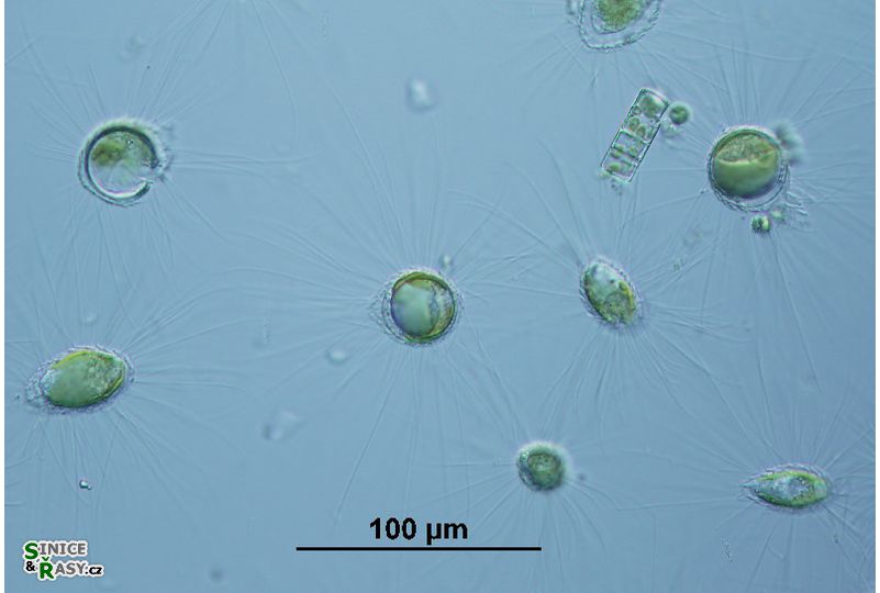 Mallomonas sp.  